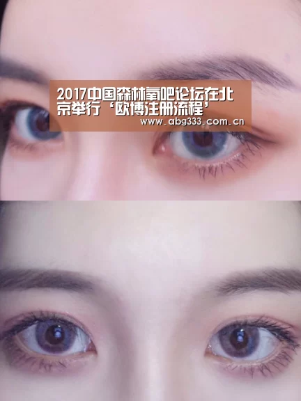 2017中国森林氧吧论坛在北京举行‘欧博注册流程’(图2) 欧博
